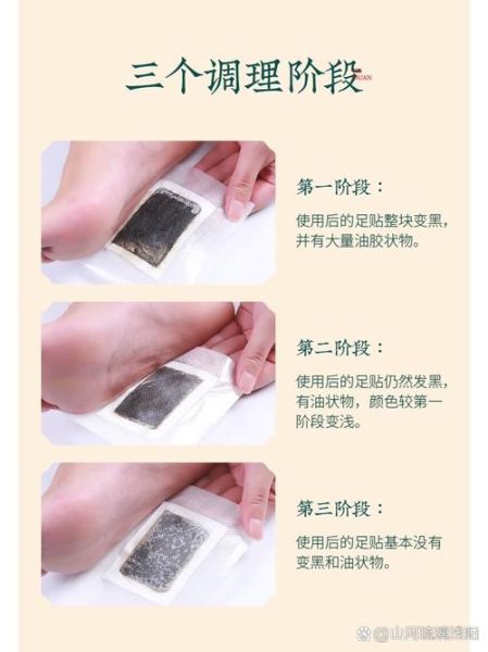 魔羯足贴有用吗_魔羯足贴使用方法